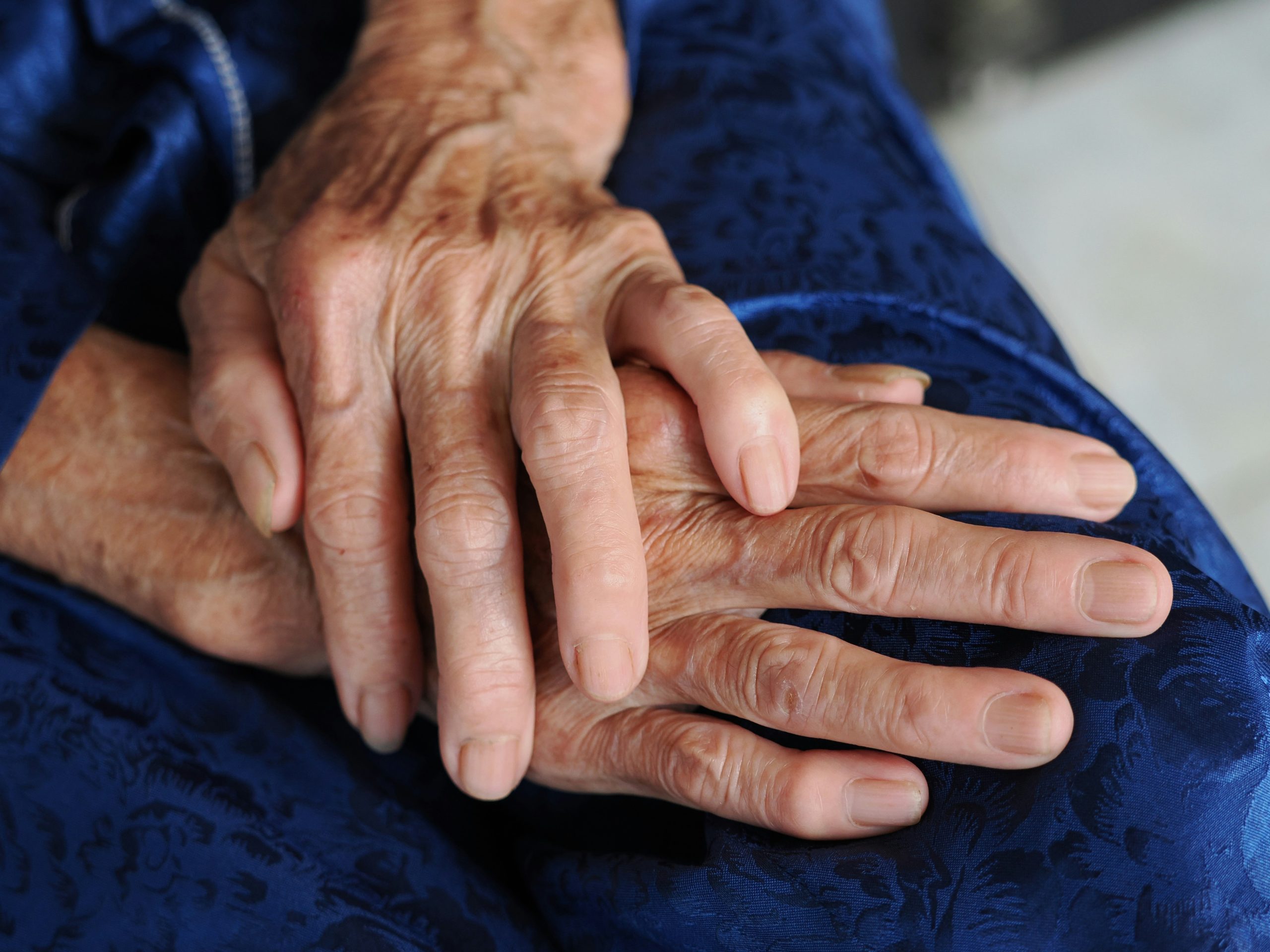 life insurance options for seniors over 80